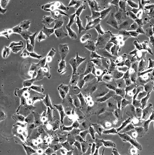 Brachyury induces a highly migratory and invasive phenotype in human epithelial tumor cells