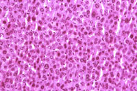 liverpath_ha1.jpg