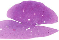 liverpath_hdn01.jpg