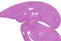 liverpath_hdn02.jpg