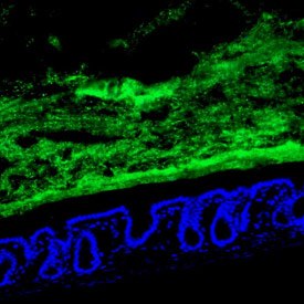 Healthy cells of the small intestine (blue) with commensal bacteria held at bay (green)