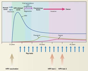 The natural history of human papillomavirus (HPV) progresses over multiple decades