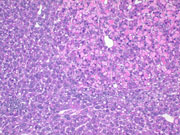 liverpath_hyb01.jpg