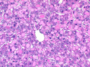 liverpath_hyb02.jpg