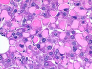 liverpath_hyb03.jpg