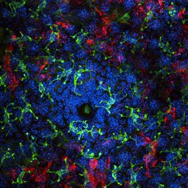 Immunofluorescent image of immune cells surrounding a hair follicle, enriched in commensal bacteria