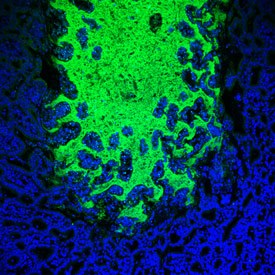 Commensal bacteria (green) invade the surface of the small intestine (blue) during parasite infection