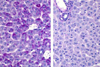liverpath_jw045.jpg