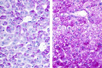 liverpath_jw048.jpg