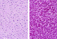 liverpath_jw055.jpg