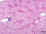 liverpath_jw083.jpg