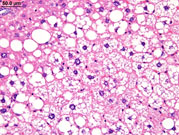 liverpath_jw084.jpg