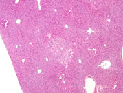 liverpath_jw094.jpg