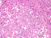 liverpath_jw095.jpg