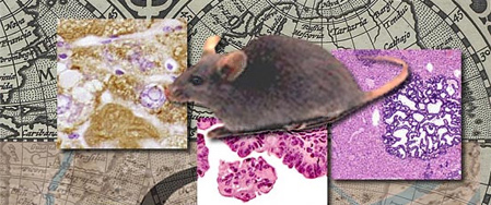 liver_lesion.jpg