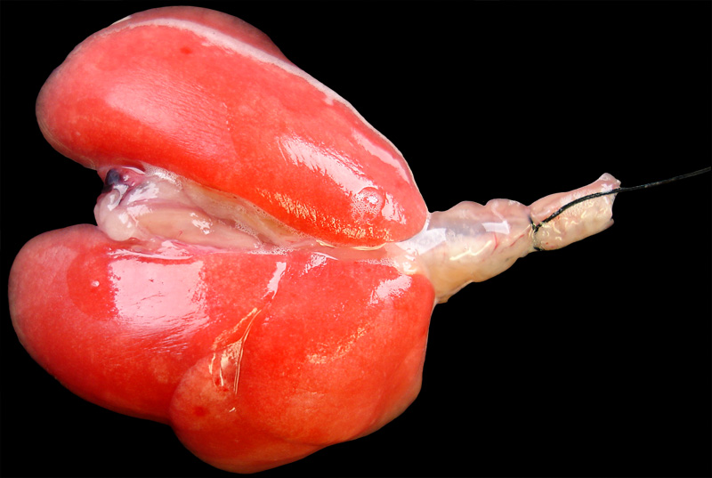 lungsinflatedlgjpg.jpg