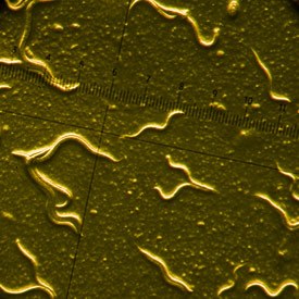 Microscope view of the nematode worm Caenorhabditis elegans