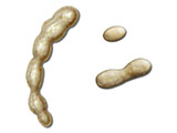 embedding_mouse_mesenteric_mandibular_bronchial_lymph_nodes.jpg
