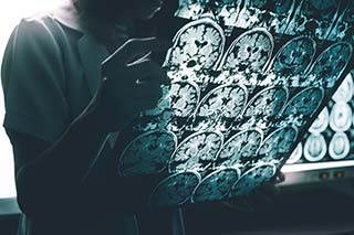 neurodegenerativediseaseimagenew.jpg