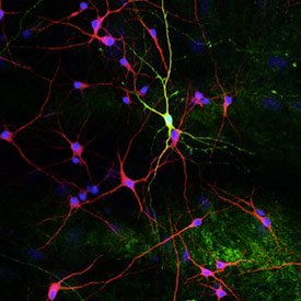 Neurons in culture