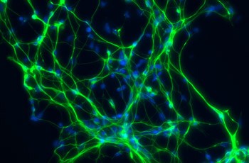 Neurons cultured from FXS iPS cells and stained with Map kinase (green) and DAPI (blue) provide insight into FX pathology