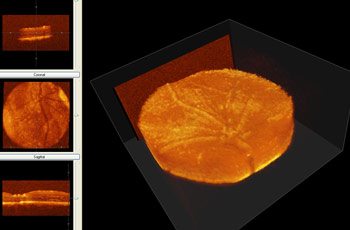 Multiple planes of the retina visualized through Optical Coherence Tomography