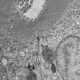 Electron Microscope image of organelles in a cell