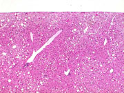 liverpath_p2200050.jpg