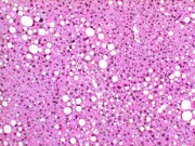 liverpath_p2200051.jpg