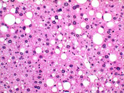 liverpath_p2200052.jpg