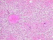 liverpath_p2200054.jpg