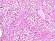 liverpath_p2200055.jpg