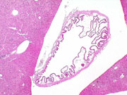 liverpath_p2200056.jpg