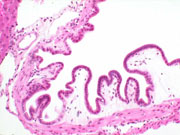 liverpath_p2200058.jpg