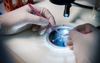 The utricle is a tiny balance organ in the inner ear, only about 0.5 mm in diameter, so handling it requires using precision tools viewed under a microscope.