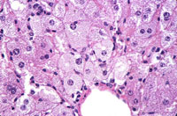 liverpath_qeth01.jpg