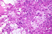 liverpath_qvac01.jpg