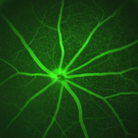 Vasculature of the retina