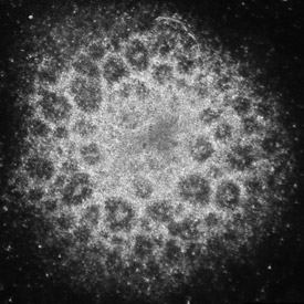 Neural rosette from Fragile X iPS cells