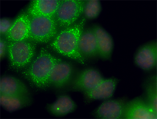 scd_imaging_of_transcription_in_live_cells.png
