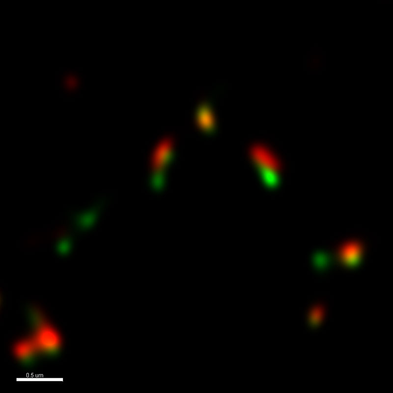 Standard confocal micrograph of regulatory proteins for chromosomal repair after deconvolution (computationally reversing optical distortion)