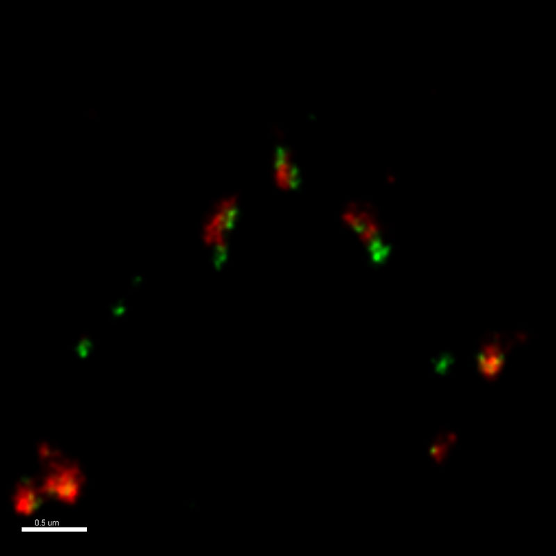 STED micrograph of the same proteins as at above-left after deconvolution, demonstrating greatly increased reolution