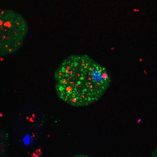 Escherichia coli bacteria (red) infecting an Entamoeba histolytica cell