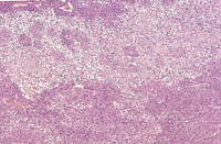 liverpath_tca01.jpg