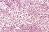 liverpath_tca02.jpg