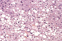liverpath_tca03.jpg