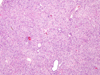 liverpath_tcb02.jpg