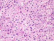 liverpath_tcb03.jpg