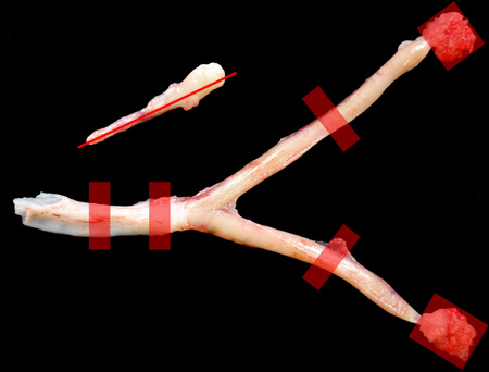 uterusbladderjpg.jpg