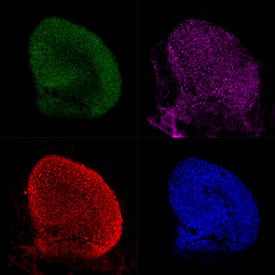 Mouse utricles with supporting cells expressing GFP (green) and labeled with anti-HSP70 (red). Hair cells are labeled with anti-myosin VIIa (pink), and all filamentous actin in the utricle is labeled with phalloidin (blue).